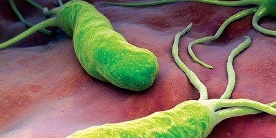 Lợi ích bất ngờ của vi khuẩn dạ dày H.Pylori