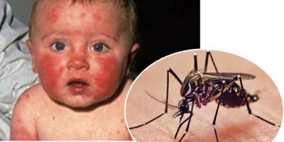 Khuyến cáo đặc biệt khi virus Zika vây kín Việt Nam