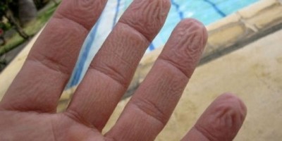 Vì sao nhăn da đầu ngón tay khi ngâm lâu trong nước?